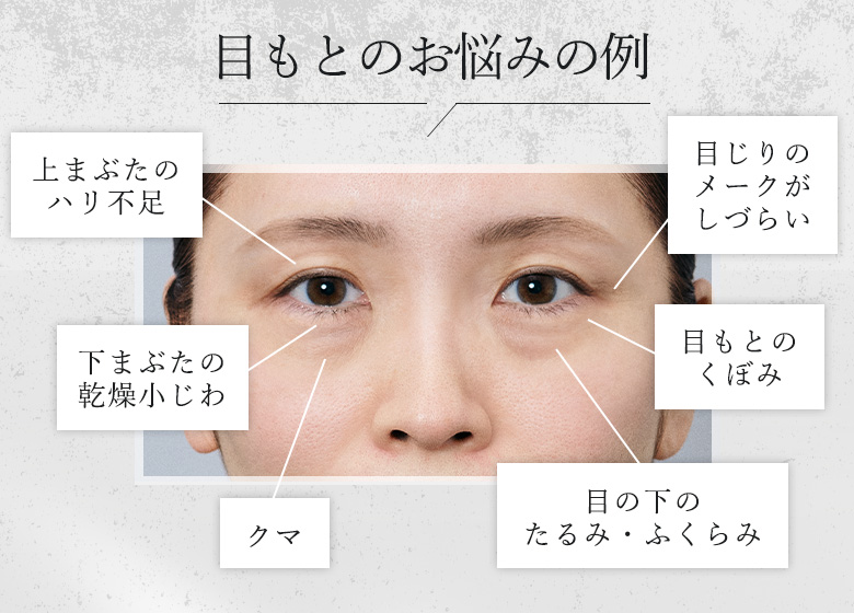 eyetrouble